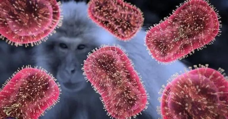 Monkeypox